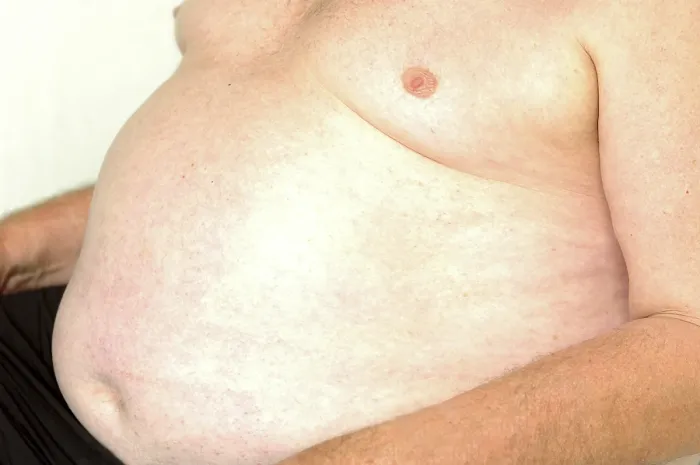 Gerahmter Druck : Dicke Bauch eines Mannes Gerahmter Druck : Dicke Bauch eines Mannes