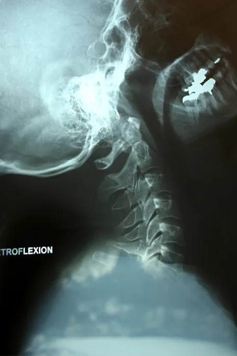 Gerahmter Druck : X-ray