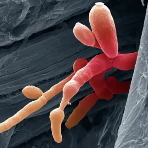 Coloured SEM Print of Candida Fungus Hyphae Coloured SEM Print of Candida Fungus Hyphae
