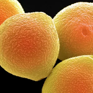 Hazel Pollen Grains Print Hazel Pollen Grains Print