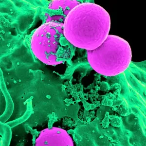 Neutrophil Engulfing MRSA Print Neutrophil Engulfing MRSA Print