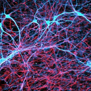 Rat neural stem cells, differentiated into neurons and glial cells, print Rat neural stem cells, differentiated into neurons and glial cells, print