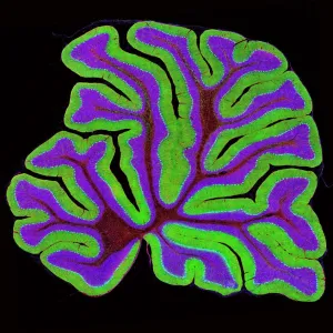 Cerebellum Structure Print, x20 Magnification Cerebellum Structure Print, x20 Magnification