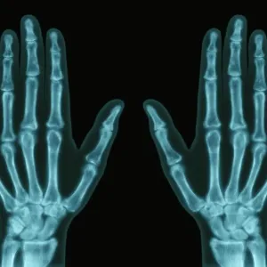 X-ray Hands Print: Science Inspired Art X-ray Hands Print: Science Inspired Art