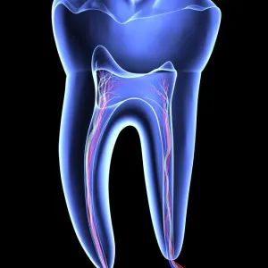 Dente molare Dente molare