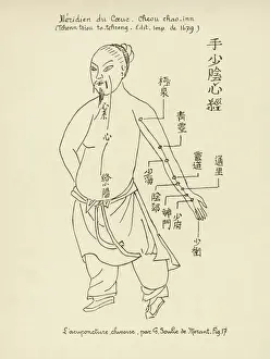 Acupuncture