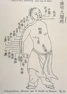 Acupuncture