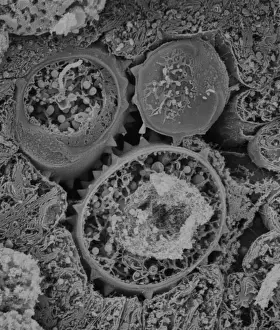 Scanning Electron Microscope Image Drucke: Asteraceae, daisy