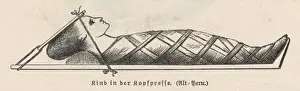 Historical Medical Equipment Drucke: Compression of Head