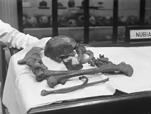 Medical Anatomy Drucke: Human Bones