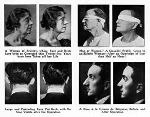 Plastic Surgery Before And After Drucke: Plastic Surgery - Before and After