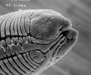 Scanning Electron Micrograph SEM Drucke: Roundworm