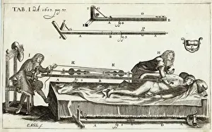 Medical Illustration Art Drucke: Setting a Bone 1682