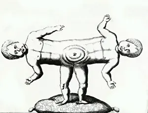 Siamesische Zwillinge / C18Th