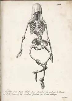 Knochenkörper von Wachstumskrankheit