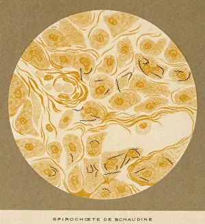 Medical History Prints Online Drucke: Syphilis Spirochaete