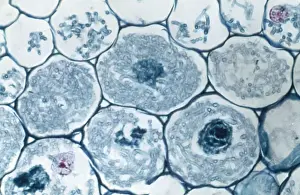 Leucht Mikroskop (LM): Fäden von Pilzen Endotropher Mykorrhizen leben innerhalb der Zellen einer Wurzel; Vergrößerung x1200 (auf einem Druck mit 10,5 cm Breite)