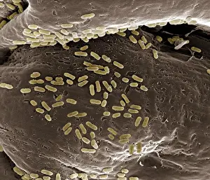 SEM Images Of Bacteria Drucke: Scanning Electron Micrograph (SEM): E