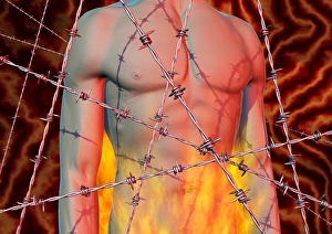 Abdominal Pain Drucke: Abominal pain