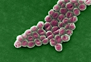 Antibiotic Resistant Bacteria Drucke: Acinetobacter baumannii bacteria, SEM