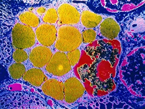 Antibody Production Process Drucke: Activated plasma cell, TEM