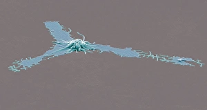 Drucke von Aktiviertes Thrombozytum. Farbenmikroskopische Elektronenbildgebung (SEM) eines aktivierten Thrombozyten oder Blutplättchens aus peripherer Blutung Bilder Datiert 2011 September: Aktiviertes Plättchen, SEM