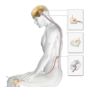 Acupuncture