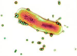 Drucke von Adenoviruspartikel und Bakterium. Farbige Transmissionelektronenmikroskopaufnahme (TEM) von Adenoviruspartikeleien (grün) mit einem Darmbakterium (orange) Bilder Datiert 2008 Januar: Virenpartikel Adeno und Bakterien, TEM