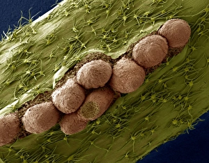 SEM Images Of Plants Drucke: Adventitious roots of ivy, SEM