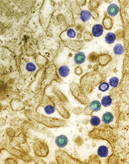 Coloured Transmission Electron Micrograph Drucke: AIDS virus particles, TEM