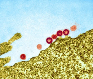 HIV-Viren aus einer Zelle auftauchen, TEM