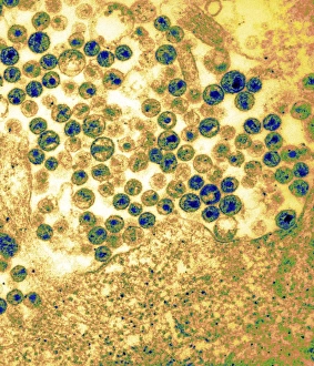 Bilder vom 23. Mai 2006: HIV-Viren aus einer Zelle austreten, TEM
