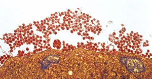 Human Immunodeficiency Virus Drucke: AIDS viruses budding from T-cell