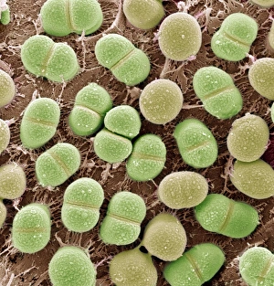 Coloured Scanning Electron Micrographs Drucke: Algae, SEM