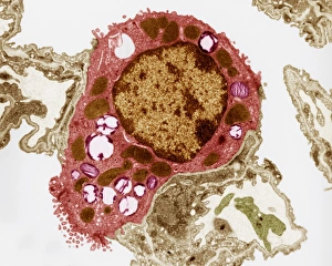 Transmission Electron Micrograph Drucke: Alveolar cell, TEM