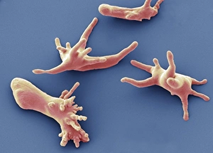 Bilder vom 7. März 2013: Protozoen amoeben, SEM