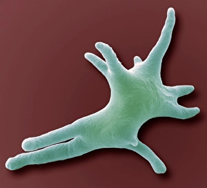 Scanning Electron Microscope Images Drucke: Amoeba, SEM