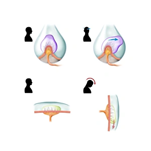 Drucke von Die Ampulläre Kuppel ist ein Computerbild, das zeigt, wie die Ampulläre Kuppel im menschlichen vestibulären System des inneren Ohres den Kopfumdrehungen (oben) und Vorwärtsbewegung (unten) wahrnimmt Bilder Datiert 2013 Januar: Kupplungskapselfülle, Kunstwerk