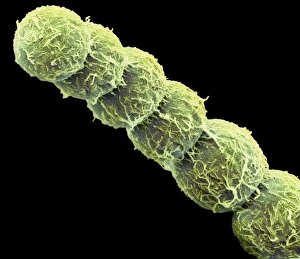 Bilder Datiert 1. November 2012: Anabaena-Algen, SEM