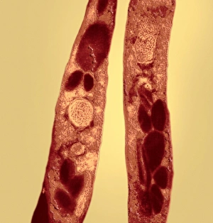Transmission Electron Micrograph Drucke: Anthrax bacteria, TEM