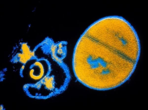 Bacteria Under Microscope Drucke: Antibiotic action on Staphylococcus