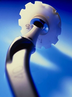Hip Replacement Surgery Drucke: Artificial hip joint