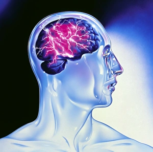 Drucke von Epilepsie. Ein Kunstwerk mit Abbildung eines epileptischen Anfalls (oder Krampfanfälle) als Blitz im Gehirn einer Modellkopffigur Bilder Datiert 2003 Februar: Bild des Epilepsien als Blitz im Gehirn gesehen wird