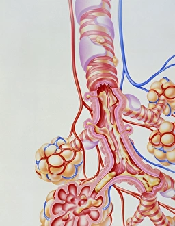 Bilder Datiert 10. Oktober 2003: Kunstwerk aus Sputum im Lungen mit chronischer Bronchitis