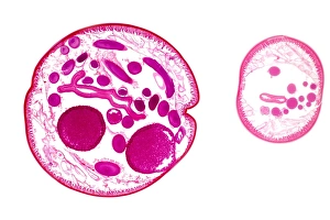 Light Micrograph Images Drucke: Ascaris roundworm, light micrograph