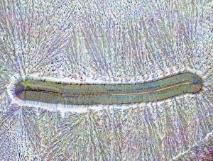 Polarised Light Microscopy Images Drucke: Ascorbic and citric acid crystals, PLM
