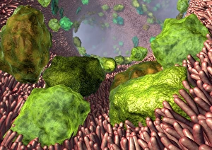 Drucke von Asthma. Computer artwork von Allergenen (grün) im Lungenleib. Allegergen wie Staub und Pollen können einen Asthmawall auslösen Bilder Datiert 2008 März: Atemwegserkrankung Kunstwerk