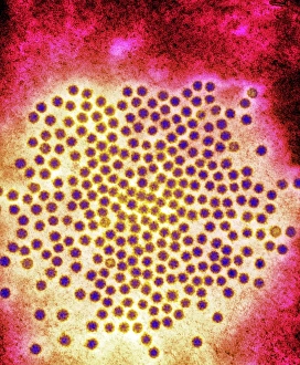 Transmission Electron Micrograph Drucke: Astrovirus particles, TEM