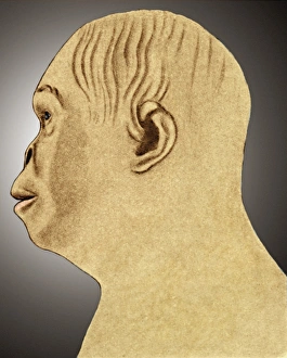Austrupithezkonstruktion