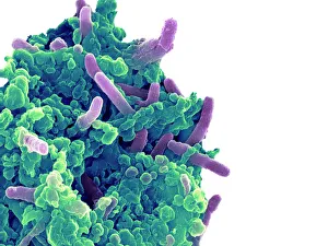Drucke von Bakterien infizieren eine Makrophage. Farbiger Scanningelektronenmikroskop (SEM) von Mycobacterium tuberculosis Bakterien (Lila) infiziert eine Makrophag-Weißblutzellen Bilder Datiert 2006 Januar: Bakterien infizieren ein Makrophag, SEM
